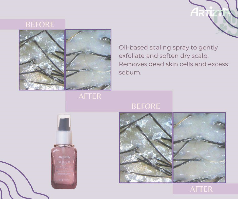Artizta Ice Scalling Spray 50ml